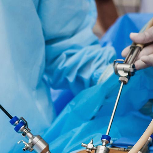 Cirurgia Geral e Laparoscópica 